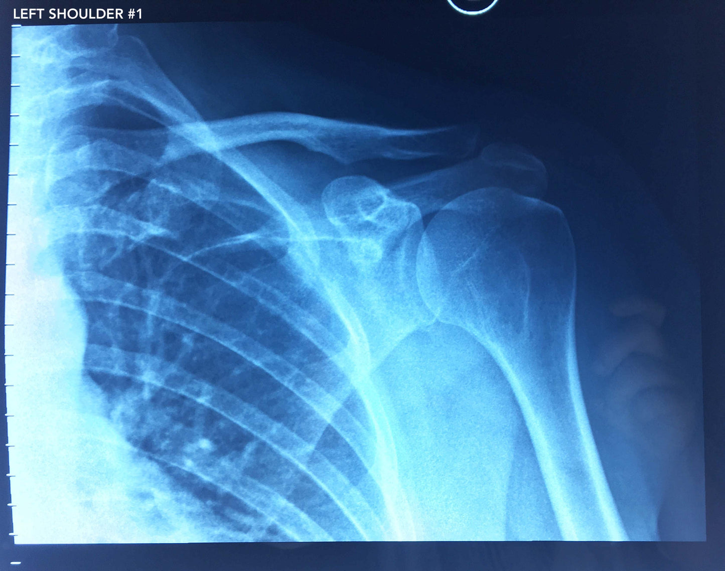 Collection of X-rays