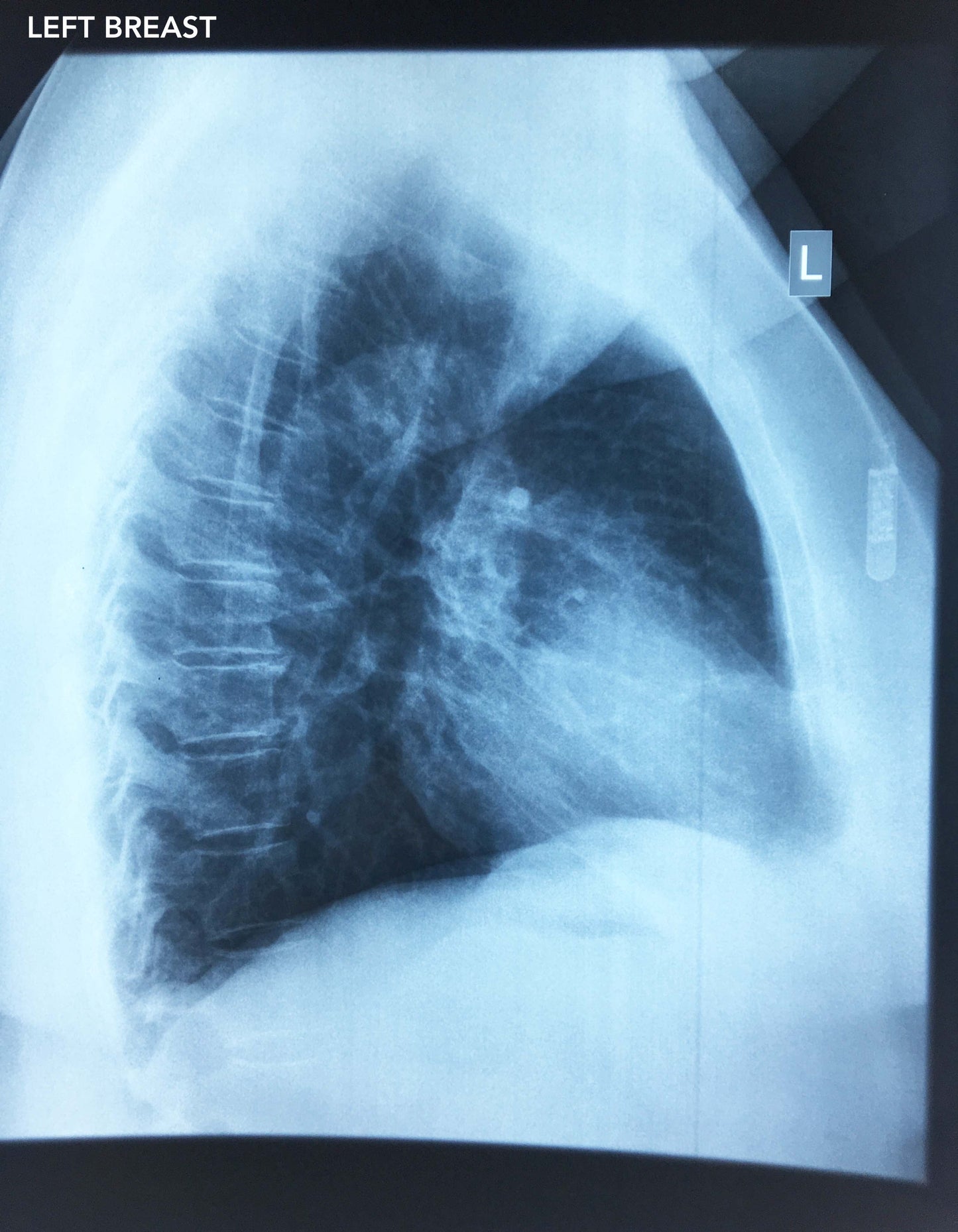Collection of X-rays