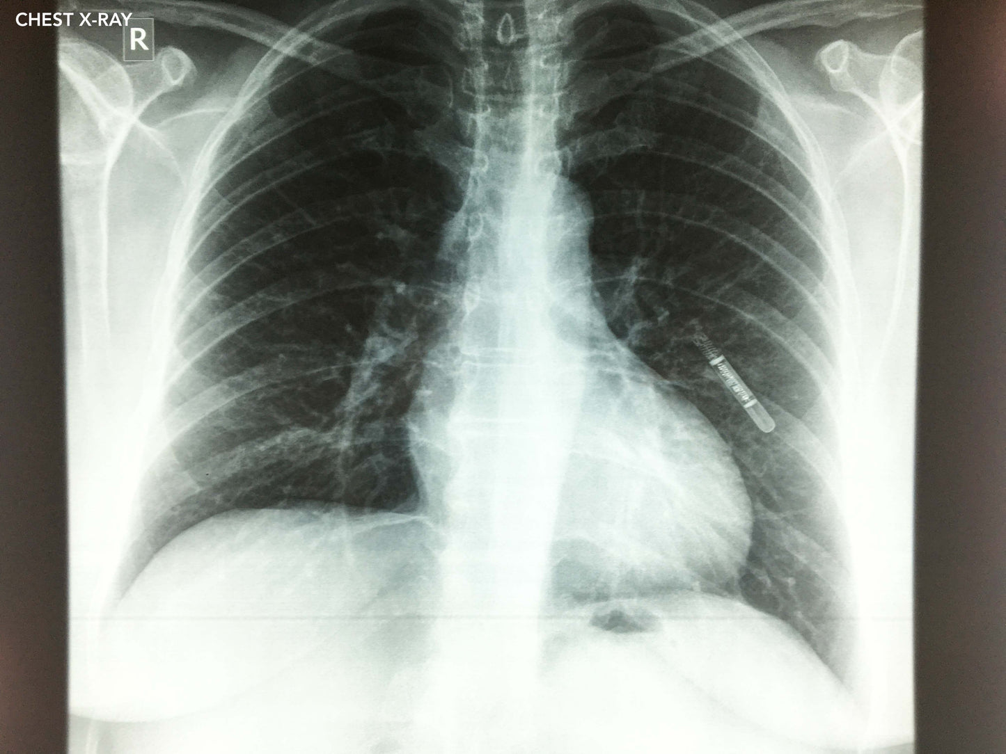 Collection of X-rays