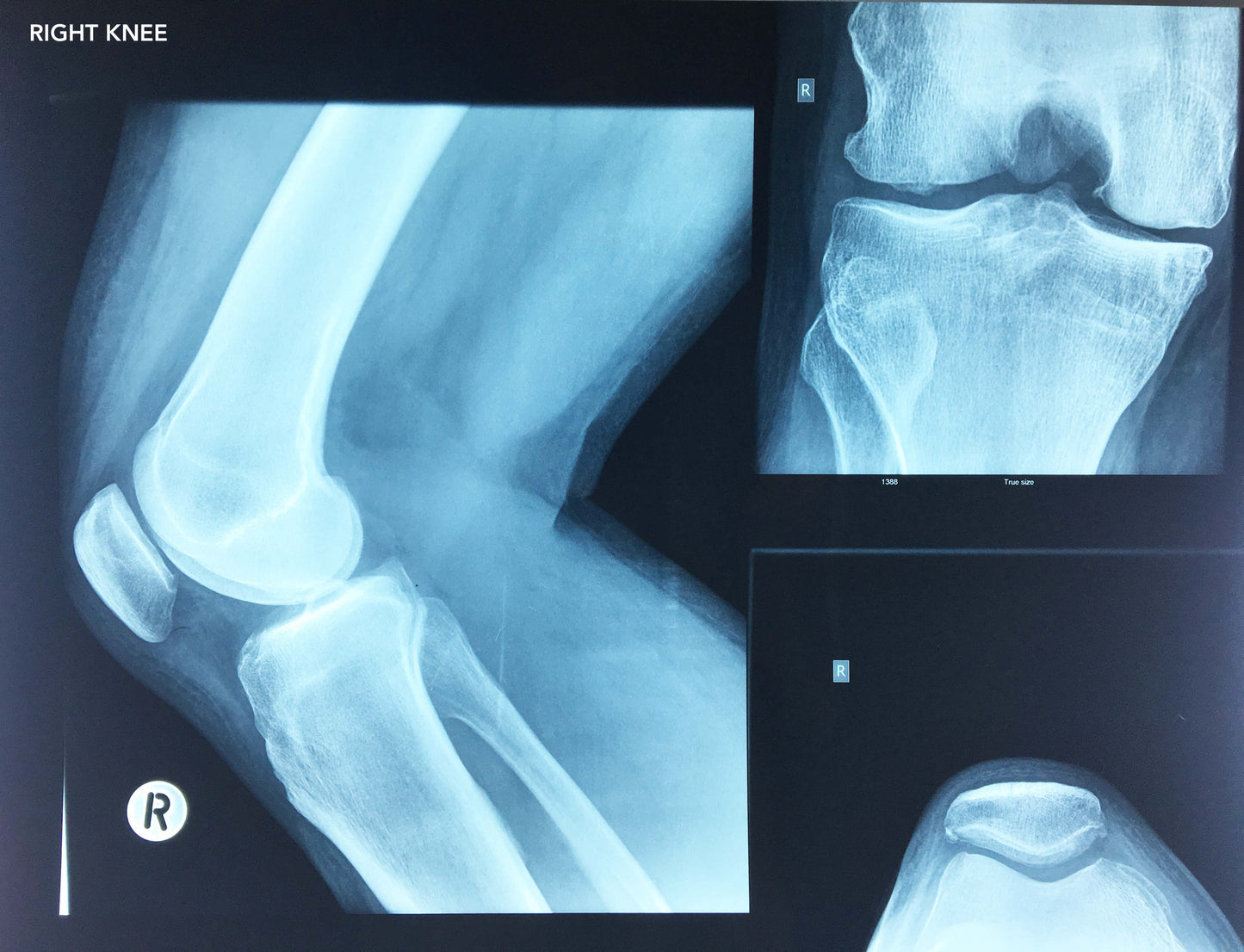 Collection of X-rays