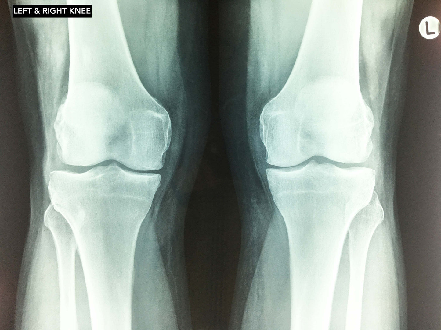 Collection of X-rays