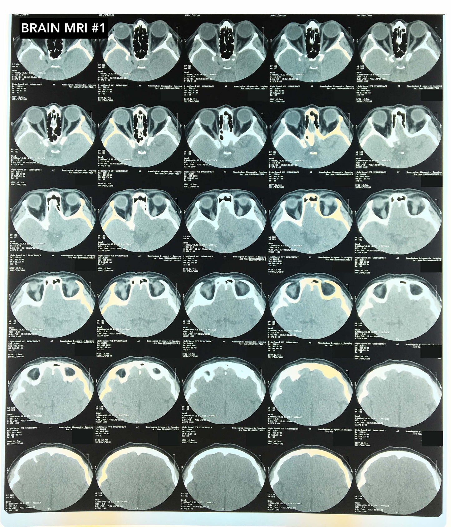 Collection of X-rays