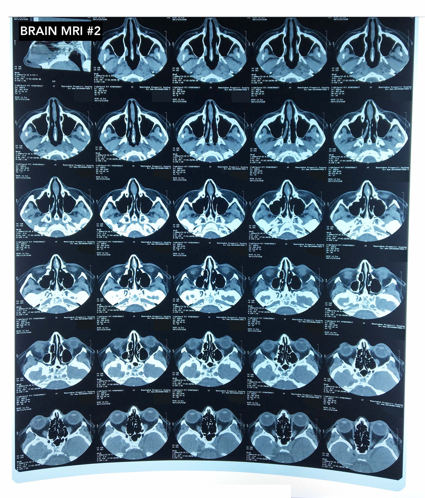 Collection of X-rays