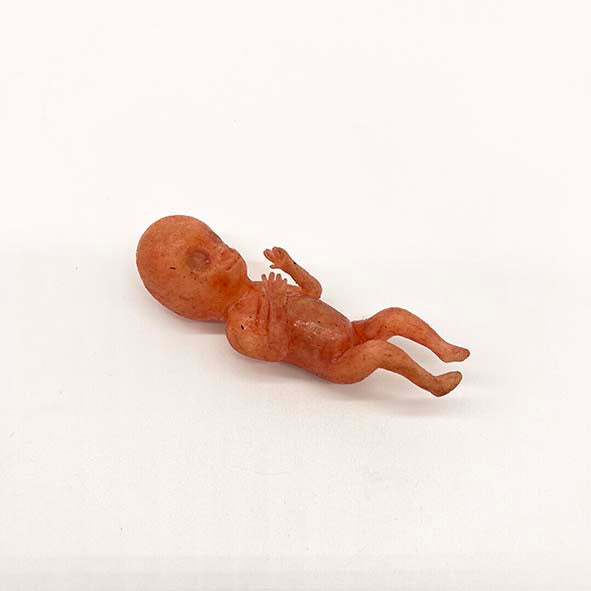 Silicone Fetus' - Various Gestations (9 - 21 Weeks)