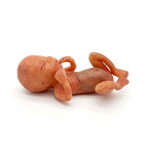 Silicone Fetus' - Various Gestations (9 - 21 Weeks)