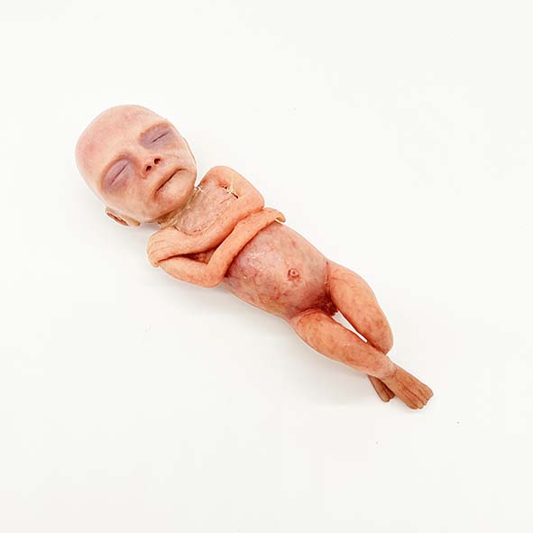 Silicone Fetus' - Various Gestations (9 - 21 Weeks)