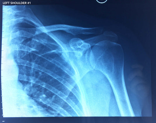 Collection of X-rays