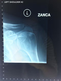 Collection of X-rays